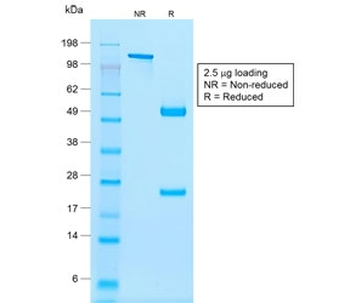 Recombinant NKX2.2 Antibody