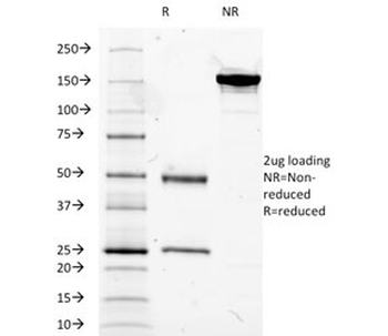 CD14 Antibody (Macrophage Marker)