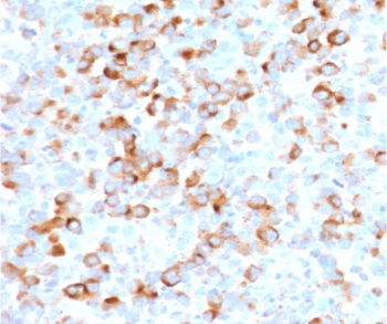 Recombinant Tyrosinase Antibody / Rabbit Monoclonal
