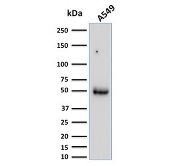 CD14 Antibody (Macrophage Marker)