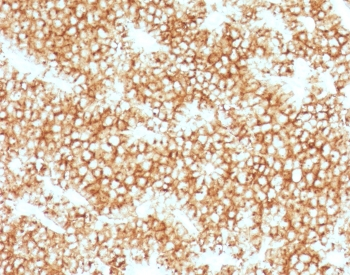 Recombinant Parathyroid Hormone Antibody (N-Terminal) / Rabbit Monoclonal
