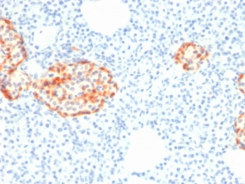Recombinant Chromogranin A Antibody