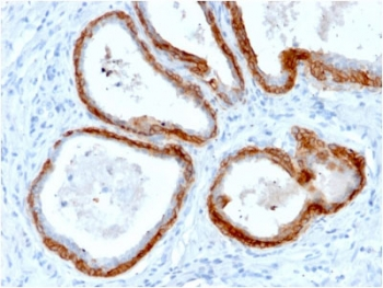 Recombinant Basic Cytokeratin Antibody / Rabbit Monoclonal