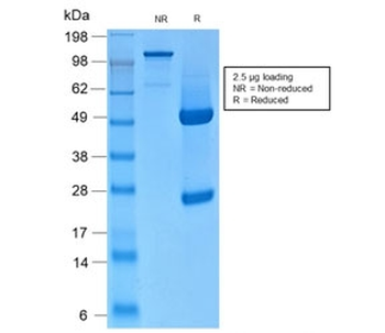 Recombinant Basic Cytokeratin Antibody / Rabbit Monoclonal