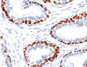 Recombinant p63 Antibody / Rabbit Monoclonal