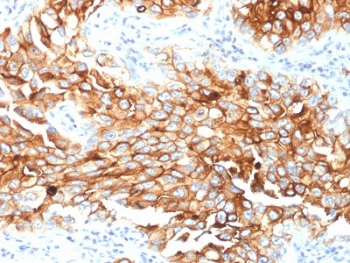 Mesothelin Antibody / MSLN