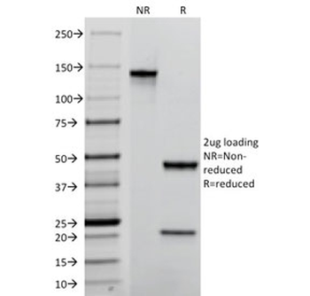 TROP2 Antibody / TACSTD2