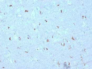 GAD67 Antibody / GAD1