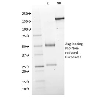 GAD67 Antibody / GAD1