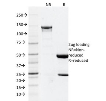 Glial Fibrillary Acidic Protein Antibody / GFAP