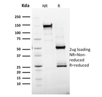 Ki-67 Antibody