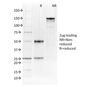 PU.1 Antibody / SPI1