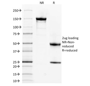 Spectrin alpha 1 Antibody / SPTA1