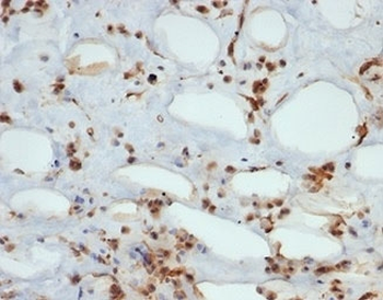 STAT6 Antibody