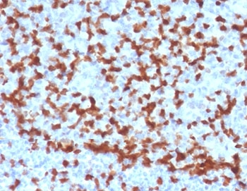 ZAP70 Antibody
