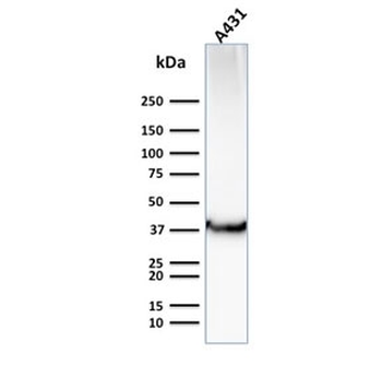 GLUT1 Antibody