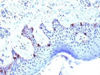 Melanoma gp100 Antibody / PMEL17
