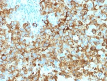 Melanoma gp100 Antibody / PMEL17