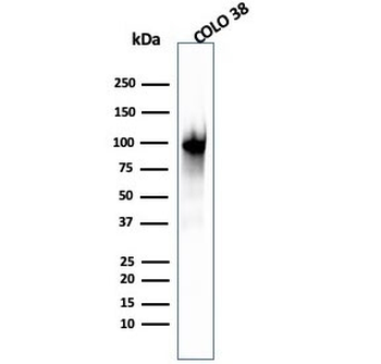 Melanoma gp100 Antibody / PMEL17