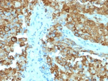 Melanoma gp100 Antibody / PMEL17