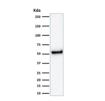 Recombinant p53 Antibody / TP53