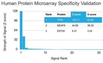Recombinant p53 Antibody / TP53