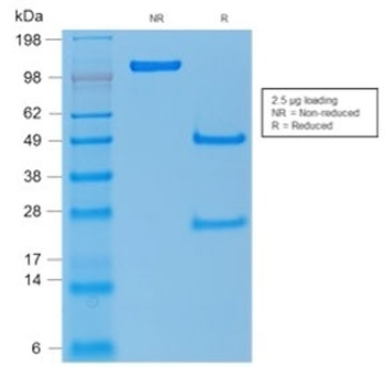 Recombinant p53 Antibody / TP53