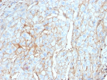 PD-L1 Antibody / B7-H1 / CD274