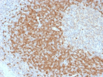 TCL1 Antibody