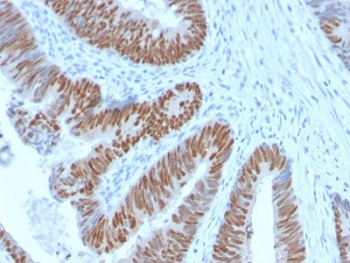 Recombinant CDX2 Antibody
