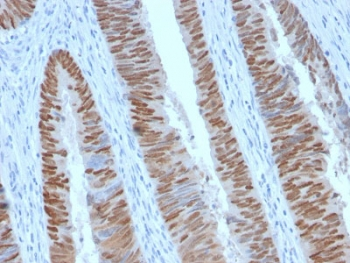Recombinant CDX2 Antibody