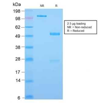 Recombinant CDX2 Antibody
