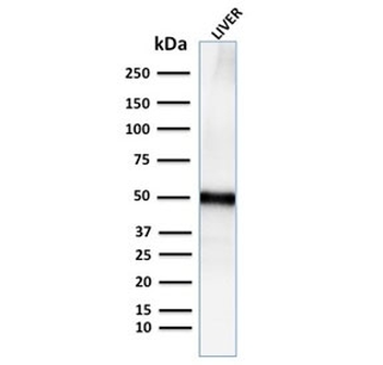 Recombinant Adipophilin Antibody / ADRP / Perilipin 2 / PLIN2