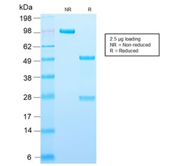 Recombinant Adipophilin Antibody / ADRP / Perilipin 2 / PLIN2
