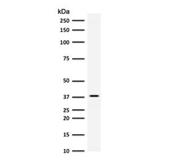 AKR1B1 Antibody / Aldose reductase