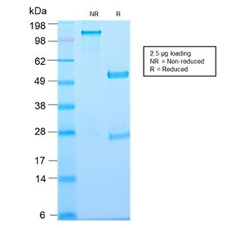Recombinant Thymidine Phosphorylase Antibody / PD-ECGF