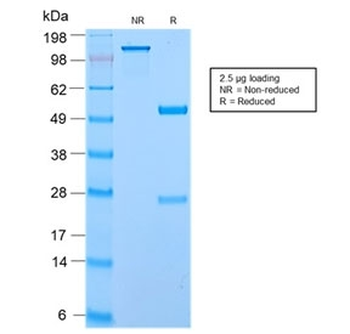 Recombinant ECM1 Antibody / Secretory Component Glycoprotein
