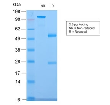 Recombinant CELA3B Antibody / Elastase 3B