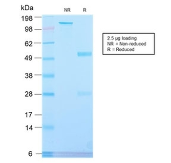 Recombinant Placental Alkaline Phosphatase Antibody