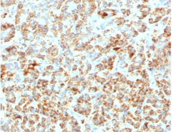 Frataxin Antibody / FXN