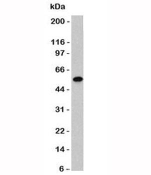 Vimentin Antibody