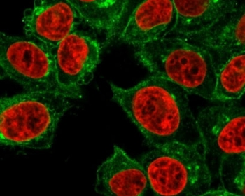B2M Antibody