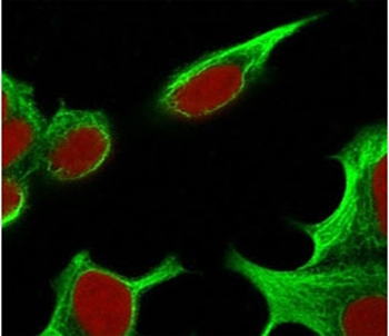 TNF alpha Antibody