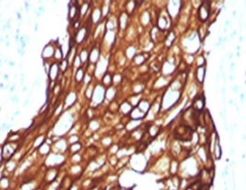 Recombinant Acidic Cytokeratin Antibody / Rabbit Monoclonal