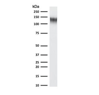 Recombinant CD31 Antibody / Rabbit Monoclonal