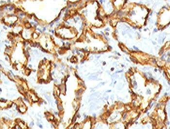 Recombinant CD31 Antibody / Rabbit Monoclonal