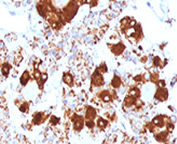 ACTH Antibody / CLIP