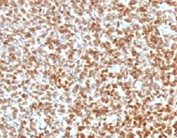 Recombinant NKX2.2 Antibody / Rabbit Monoclonal