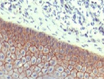 E-Cadherin Antibody / CDH1