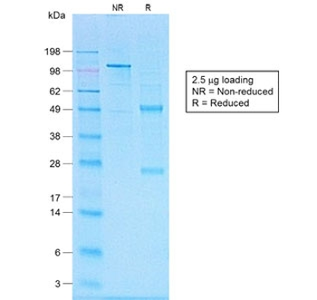 Recombinant CD20 Antibody / Rabbit Monoclonal
